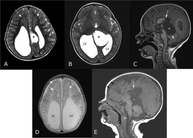 FIG. 3.