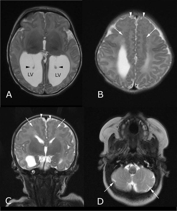 FIG. 2.