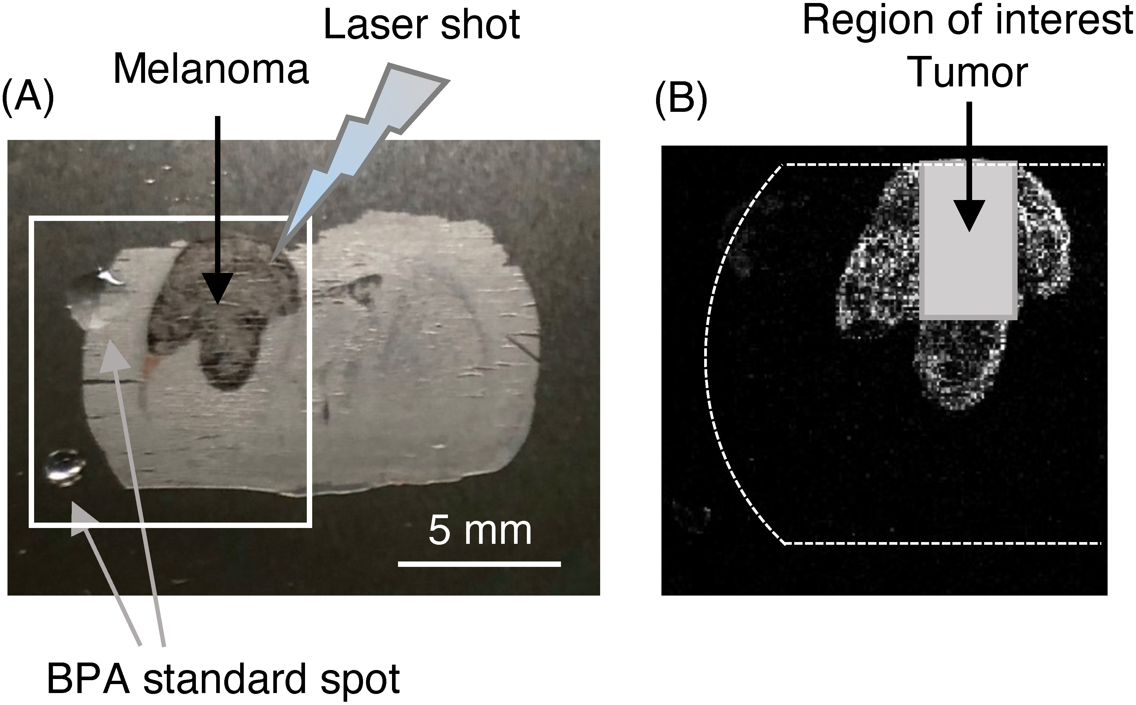 Fig. 3. (A) Brain tissue section with melanoma administered with BPA. MALDI-MSI was performed in the half area enclosed by square. The spotted BPA standard (upper: 100 pmol, lower: 20 pmol) outside brain section were used to confirm the detection of BPA (B) tumor area designated as a region of interest (ROI).