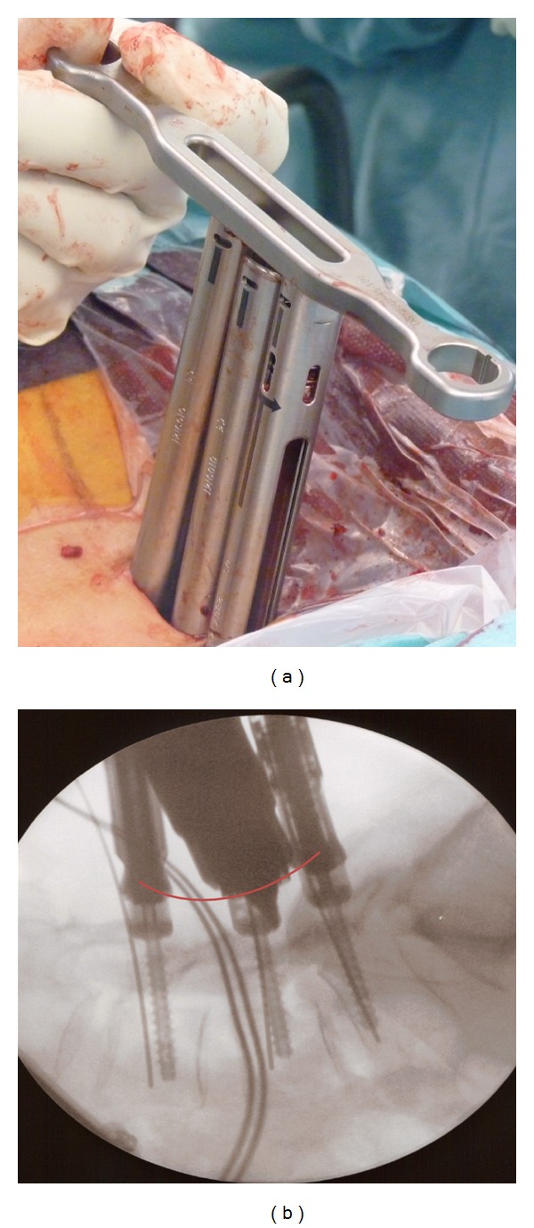 Figure 4