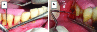 [Table/Fig-4]