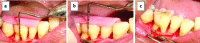 [Table/Fig-3]