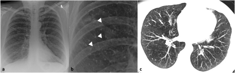 Fig. 13