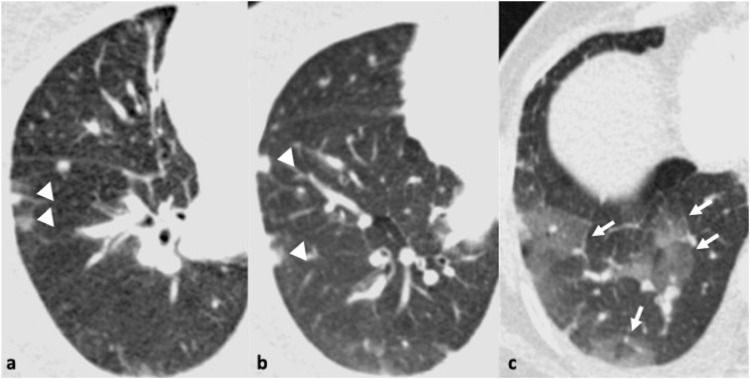 Fig. 5