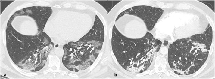 Fig. 11