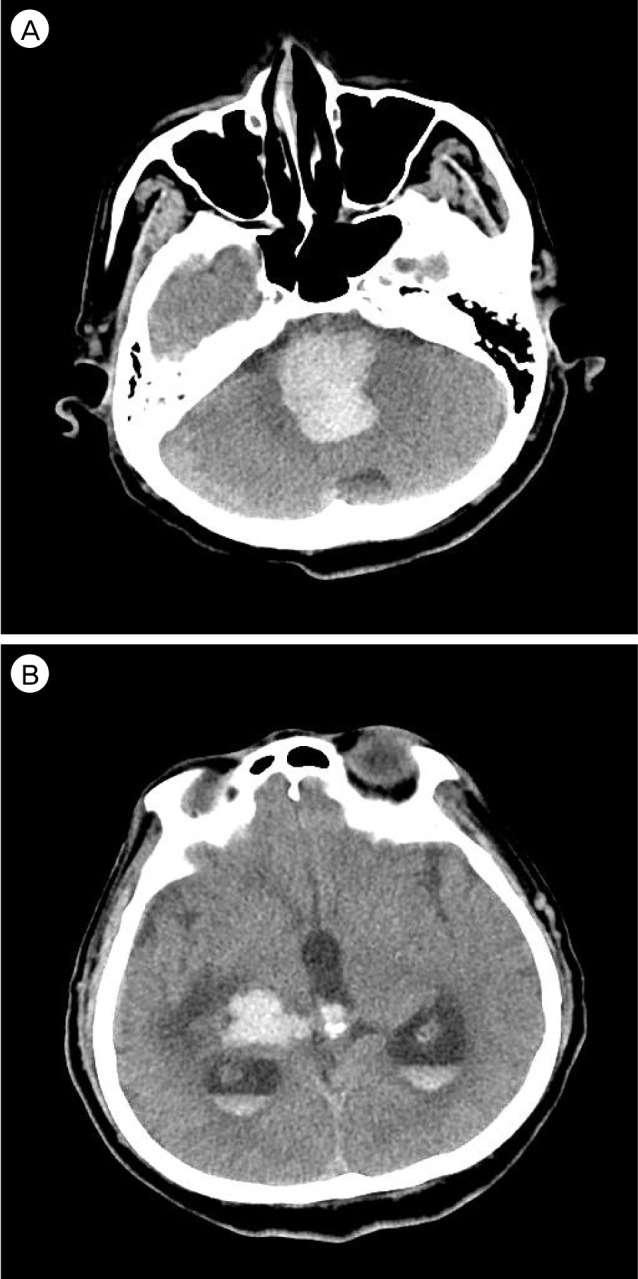 Fig. 5