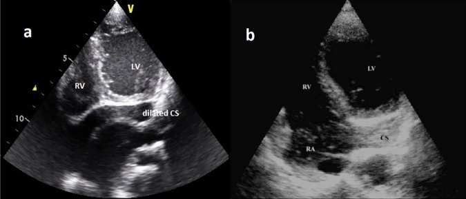 Figure 2