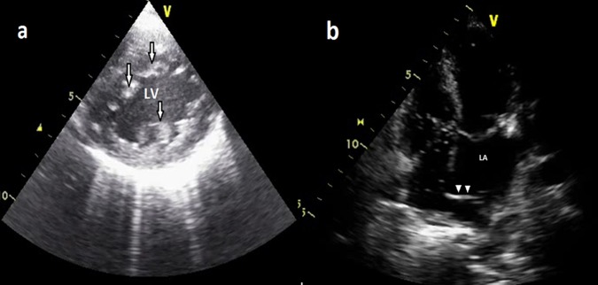 Figure 1