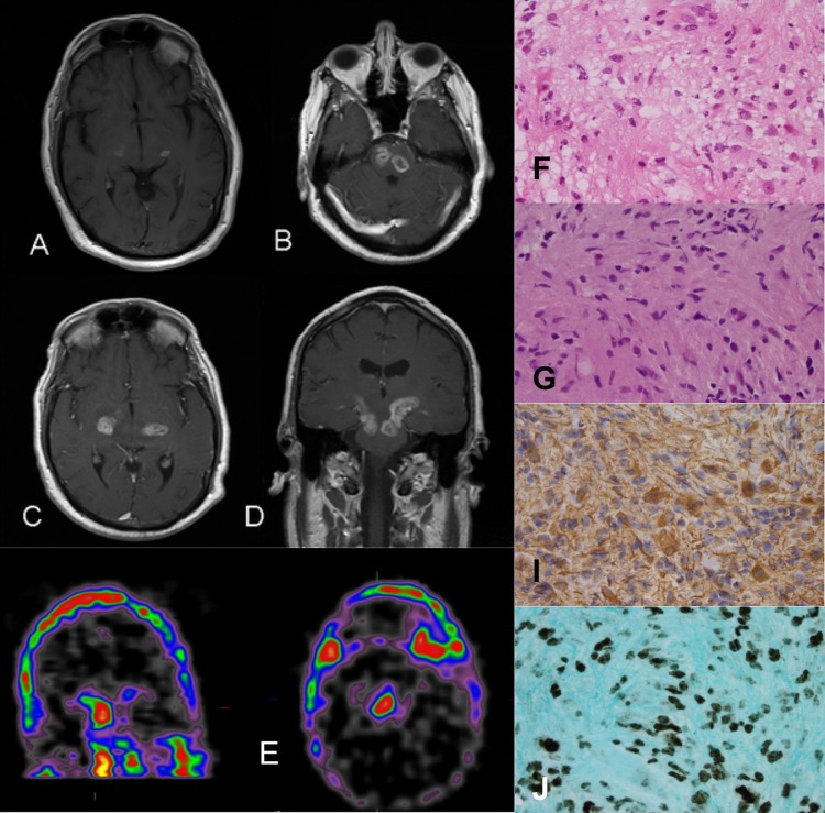 Figure 1