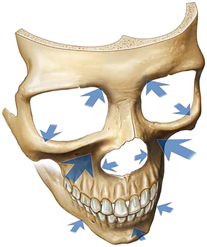 Fig. 24