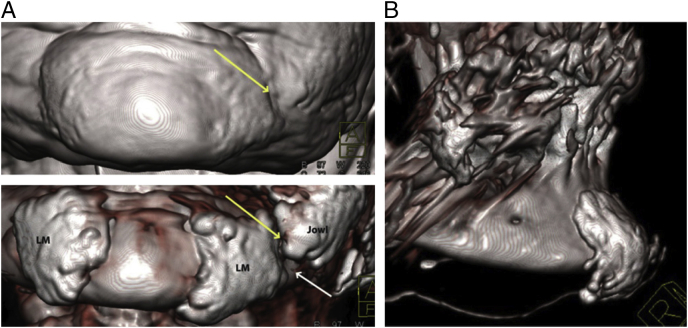 Fig. 19