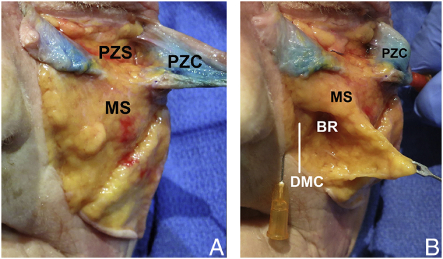 Fig. 21