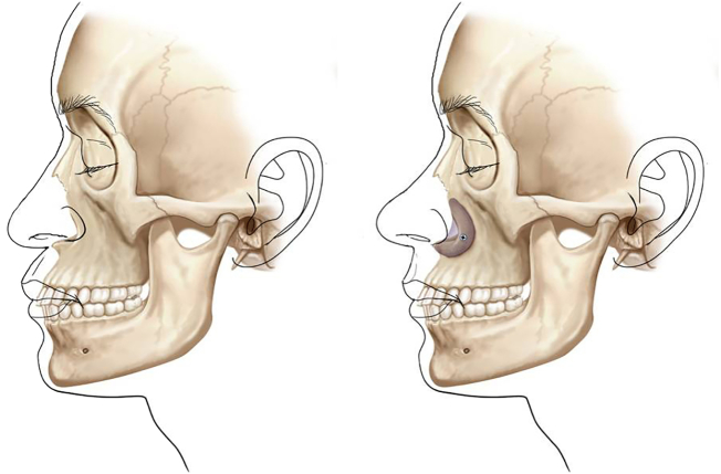 Fig. 25