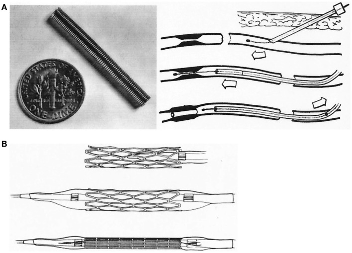 Figure 17