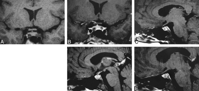 fig 2.