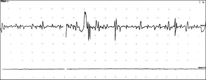 Fig. 3