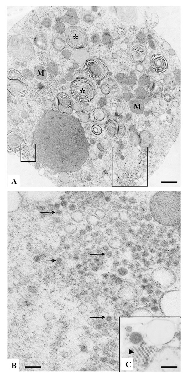 Vero cells six days post inoculation with a human blood serum sample positive for ZIKV. (A) Infected Vero cell presenting numerous myelin figures (*), vacuoles, and clusters of ZIKV particles (marked areas); bar = 700 nm; (B) ZIKV particles (arrows); bar = 120 nm; (C) regularly arranged viral nucleocapsids (arrow head); bar = 300 nm.