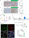 Figure 2. APOE is highly expressed by TAM. A, IHC analysis of APOE in human benign pancreas and PDAC samples. Scale bars, 100 μm. B, Quantitation of positive APOE staining as a percentage of area in a 20× field of view. At least three fields of view were averaged per sample. Adjacent/normal pancreas, n = 3; hPDA, n = 4. Statistical significance was determined using two-tailed t test. C, IHC analysis of APOE in normal mouse pancreas and orthotopic KPC tumor. Scale bars, 100 μm. D, Quantitation of positive APOE staining as a percentage of area in a 20× field of view. Five fields of view were averaged per mouse. Control, n = 3; orthotopic tumor, n = 6. Statistical significance was determined using two-tailed t test. E, UMAP visualization of 9 identified populations in orthotopic KPC tumors (n = 2). F, Violin plot of normalized expression of Apoe in identified cell populations in orthotopic KPC tumors (n = 2). G, Coimmunofluorescence of orthotopic KPC tumor with single channels of APOE (green), F4/80 (red), αSMA (white), and merge to show APOE and F4/80 colocalization. Two examples of APOE and F4/80 colocalization are denoted by white arrowheads. Scale bars, 25 μm. H, Experimental design for bone marrow–derived macrophage polarization assay. I, qRT-PCR analysis of Apoe mRNA levels relative to Cyclophilin A in four macrophage conditions (M0, M1, M2, and TAM). Statistical significance was determined using one-way ANOVA with Tukey test for multiple correction.