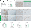 Figure 3. Loss of APOE results in reduced tumor burden and fibrosis. A, Experimental scheme for orthotopic transplantation of 7940b, KPC tumor cells. B, Final tumor weight (g) in WT (n = 10) and ApoE–/− (n = 13) mice. Statistical significance was determined using two-tailed t test, with a P < 0.05 considered statistically significant. C, Representative IHC for APOE in WT and ApoE–/− mice. Scale bar, 100 μm. D, Representative IHC staining for Ki-67, cleaved caspase-3 (CC3), F4/80, and CD3 in WT and ApoE–/− mice. Scale bars, 100 μm. E, Quantitation of IHC stain as a percentage area per 20× field in WT (n = 4–8) and ApoE–/− mice (n = 5–8). Statistical significance was determined by two-tailed t tests. n.s., not significant.