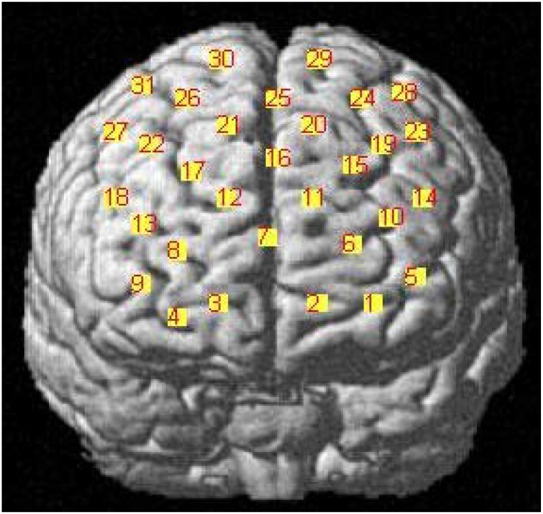 FIGURE 2