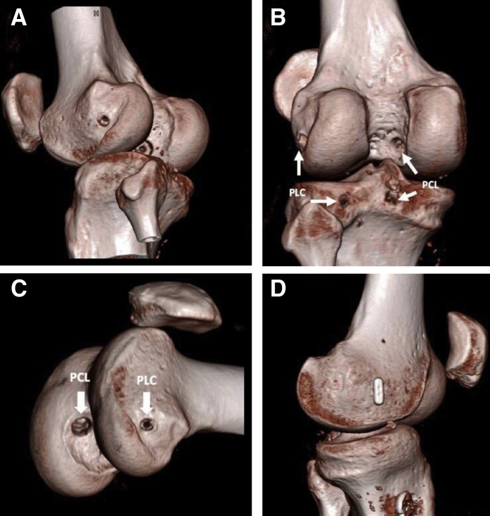 Fig 4