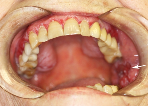 Fig. 1