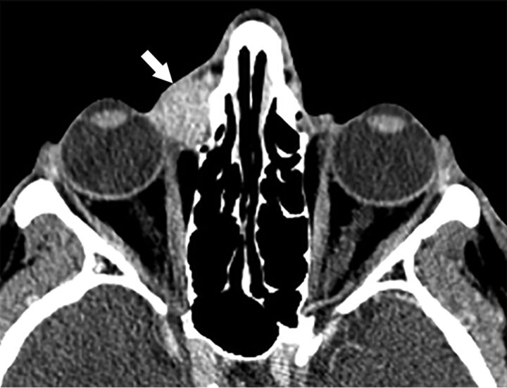 Fig 2.