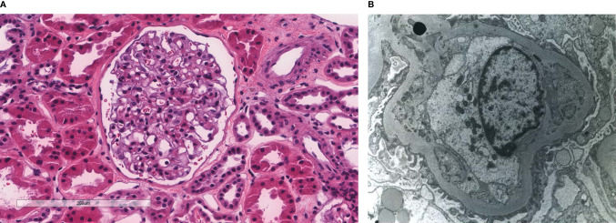 Figure 2