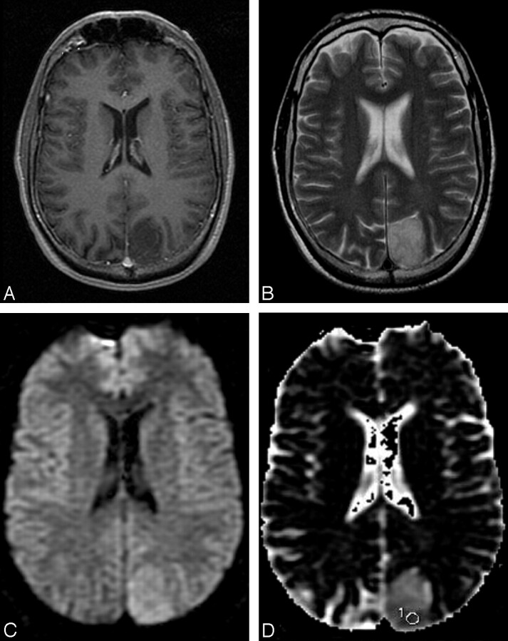 Fig 3.