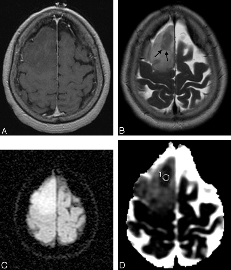 Fig 2.