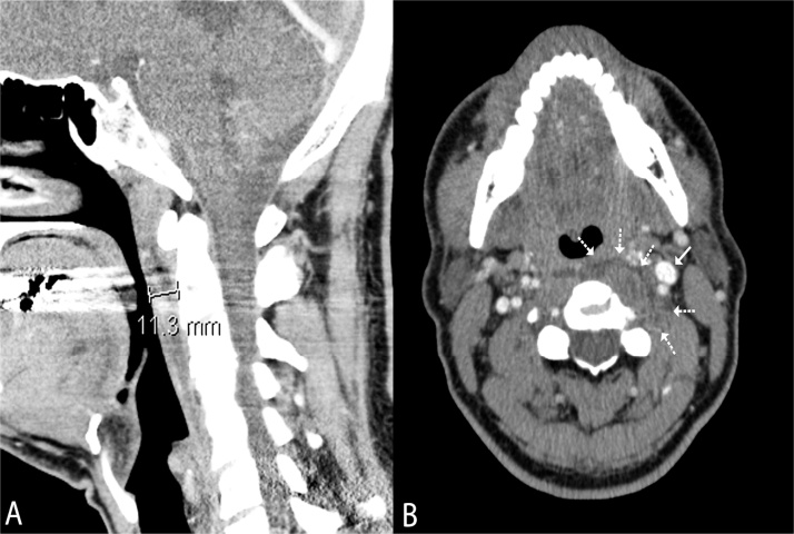 Fig. 2