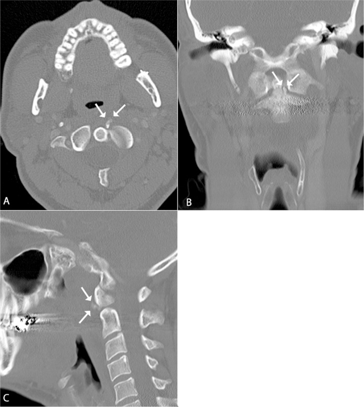 Fig. 1