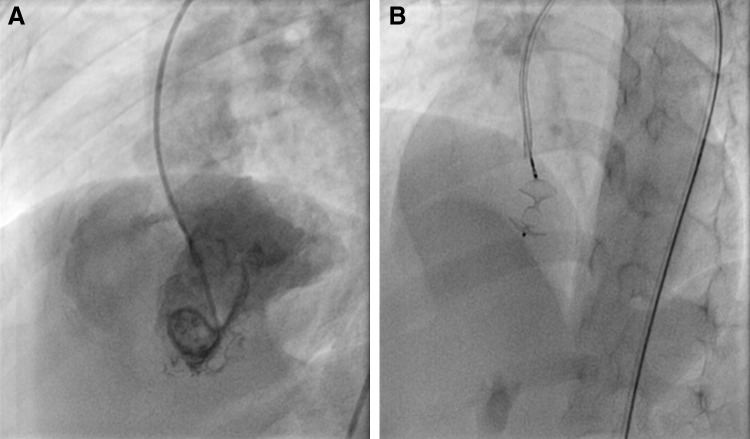 Fig. 1