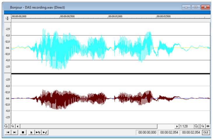 Figure 25