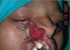 Figure 4a