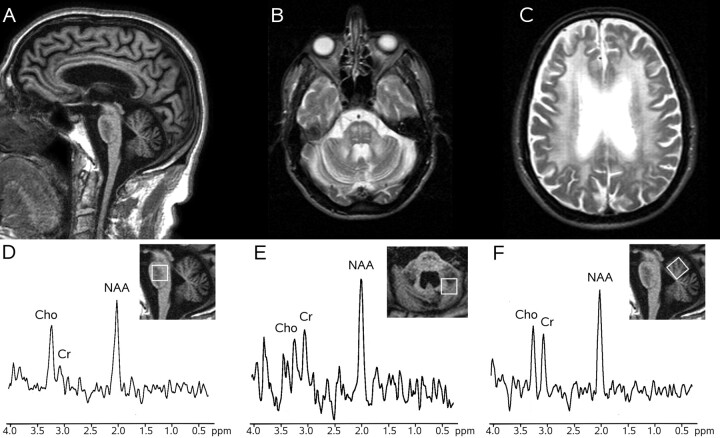 Fig 2.