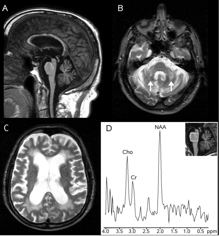 Fig 1.