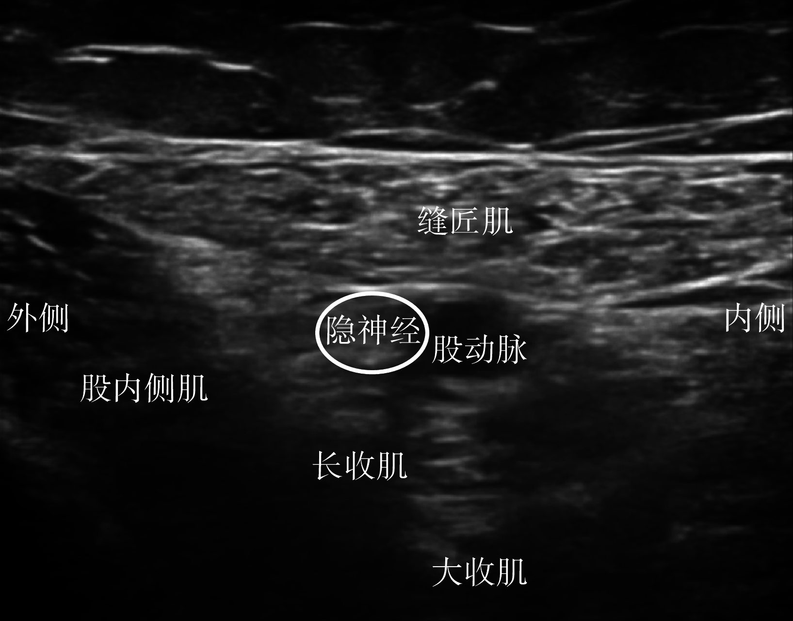 图 1