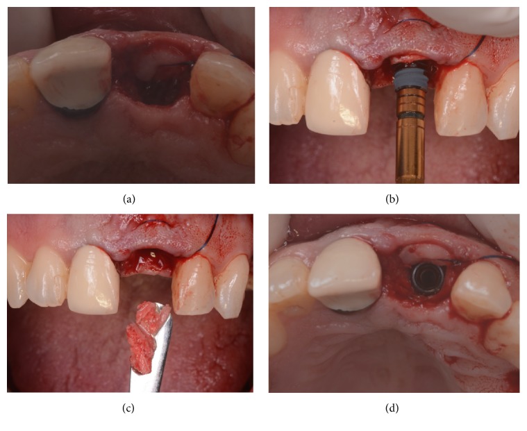 Figure 4