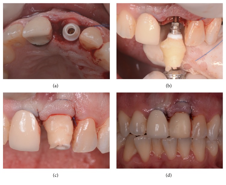 Figure 5