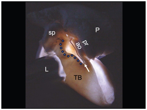 Figure 14