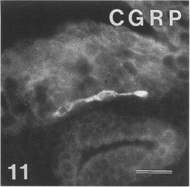 Fig. 11