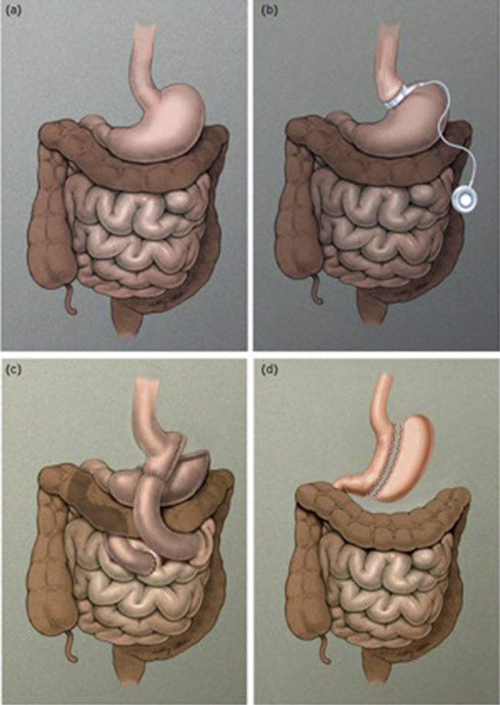 Figure 1