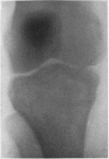 164-1