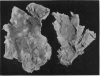 152-2