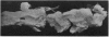 148-2