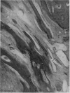 160-4