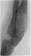 152-3