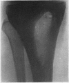 164-1