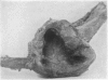 156-2